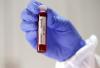 Birleşik Krallık ta koronavirüs antikor testleri yakında satışa sunulacak