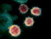 Birkaç dakikada sonuç veren koronavirüs testleri ne kadar güvenilir